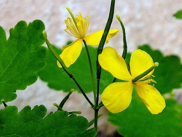 Celandine per il trattamento della psoriasi